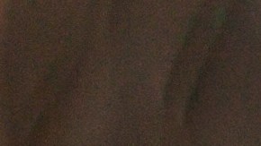 Por su alto contenido de vitaminas C y A, las fresas son excelentes para la salud de la piel.