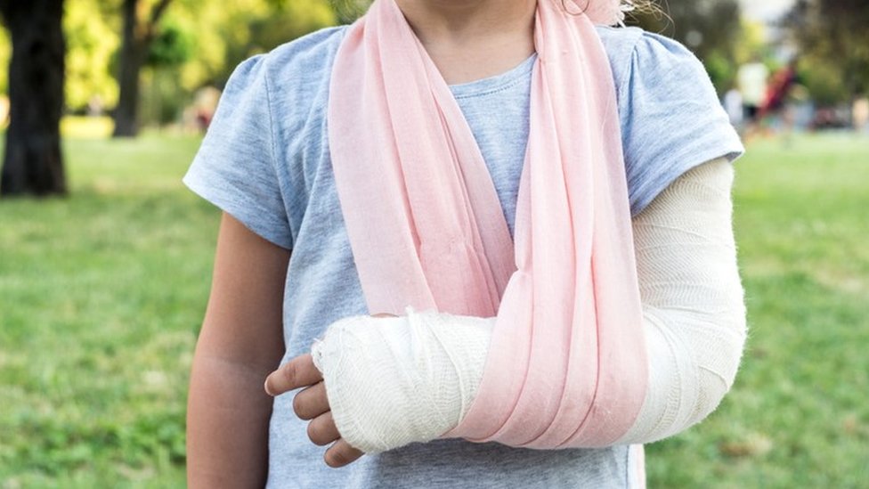 Vidrio, el mejor material para reparar huesos rotos