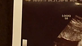 Alicia Zeek and Zac Smith esperaban una niña, pero en la ecografía vieron algo más.