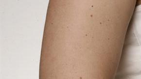 La mujer se encontraba en el octavo mes de gestación.