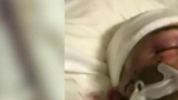 Evan Jiménez, de 15 años, luchando por su vida en el hospital.