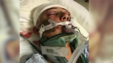 Evan Jiménez, de 15 años, luchando por su vida en el hospital.