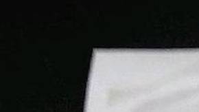 Nelson llegó al hospital con quemaduras de segundo y tercer grado