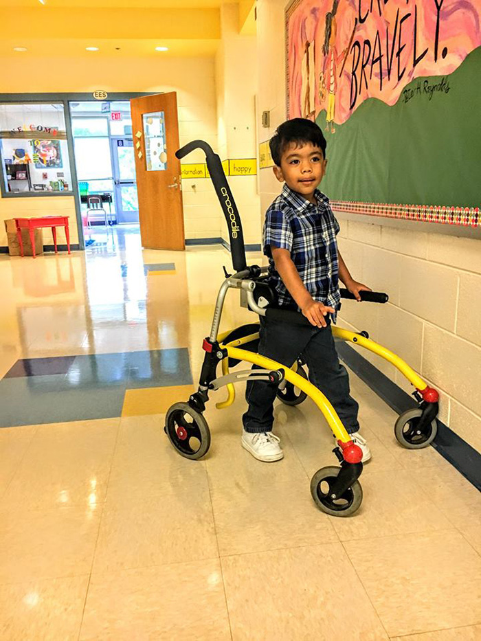 Dylan asiste a su prime día de escuela tras superar 22 operaciones cerebrales.