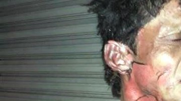 José Ramón Escobedo tuvo que ser atendido en el Hospital Rubén Leñero por las lesiones que las llamas le dejaron. Foto: Especial