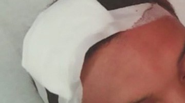 Un joven del Bronx víctima de un disparo en la cabeza.