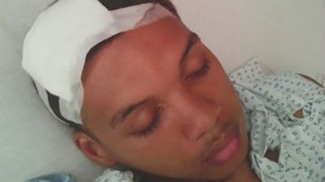Un joven del Bronx víctima de un disparo en la cabeza.