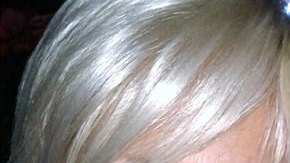 Rachel y Christine Hoggins estaban muy unidas hasta que, lamentablemente, un cáncer las separó.