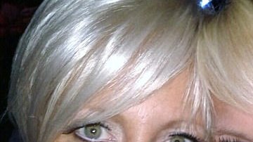 Rachel y Christine Hoggins estaban muy unidas hasta que, lamentablemente, un cáncer las separó.