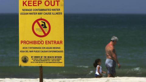 Un rótulo advierte sobre la contaminación.