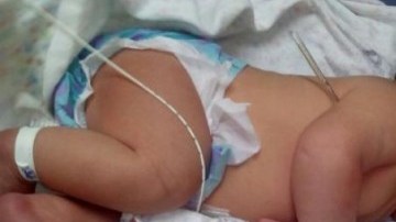 Nace el bebé más grande, con un peso de más de 12 libras.