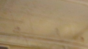 Personas reciben tratamiento dental en una megaclínica en Los Ángeles. (Aurelia Ventura/ La Opinion)