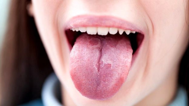 porque cuando tomo cerveza se me pone la lengua blanca