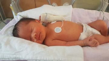 Eiko, que se ve aquí en la UCI neonatal del Hospital Mount Sinai, fue dada por cesárea el 19 de agosto, más de dos meses después de haber sido operada dentro del útero de su madre.