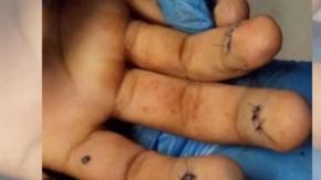 Jesús "El Kalimba" Martín se había operado las yemas de los dedos para borrar sus huellas dactilares, según la fiscalía.