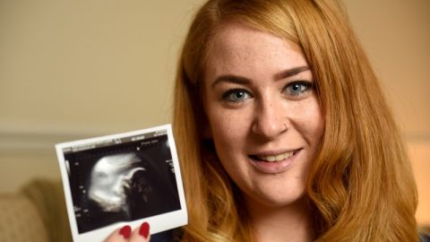 Laura Bacon-Smith con la ecografía de su bebé cinco años después de que le dieran seis meses de vida.