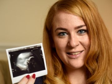 Laura Bacon-Smith con la ecografía de su bebé cinco años después de que le dieran seis meses de vida.