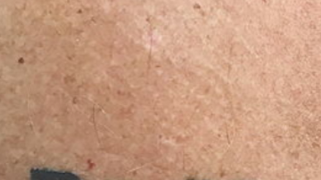Este tatuaje ocasionó un debate ético.