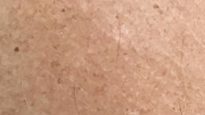 Este tatuaje ocasionó un debate ético.