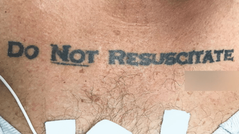 Este tatuaje ocasionó un debate ético.