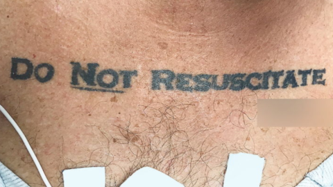 Este tatuaje ocasionó un debate ético.