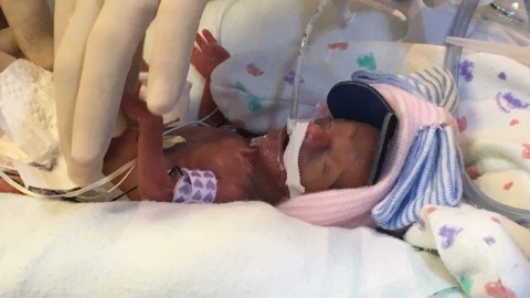 Lailie Victoria, la "niña milagro", en el Hospital Bautista de Niños.
