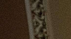 Tras una cirugía, el senador McCain había seguido su labor en el Senado.