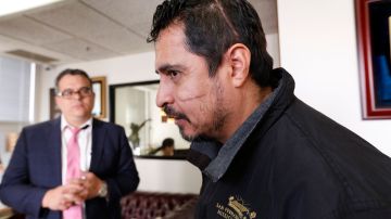 01/23/18 /LOS ANGELES/Mexican immigrant Armando Sandoval shows his stabbed wounds (Photo by Aurelia Ventura/La Opinion)