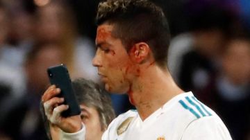 Cristiano Ronaldo bañado en sangre. EFE/ Juan Carlos Hidalgo