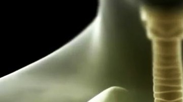 Uno de los casos de tuberculosis se detectó en una escuela de Burbank.