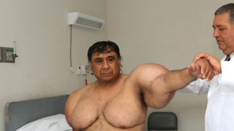 Tras años sin tratamiento, el Centro Médico Naval estudia ahora su caso. (Foto: Feliciano Herrera)