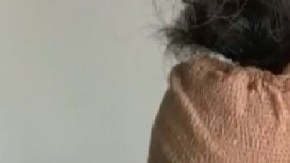 La víctima, a la izquierda, después de presuntamente ser golpeada por el sospechoso, a la derecha.