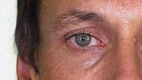 Brett Peter Cowan (en la foto) fue atacado con agua caliente.