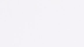 Así lucen las piedras o cálculos biliares de tipo pigmentado,