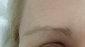 Narelle Krikhoff, de 53 años, descubrió que tenía cáncer y que no era una marcad e los lentes.