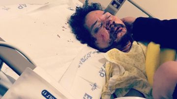 Pedro Daniel Reyes fue atacado brutalmente el domingo por la mañana.