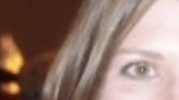 Christin Lipinski padece una enfermedad que le devora el tejido.