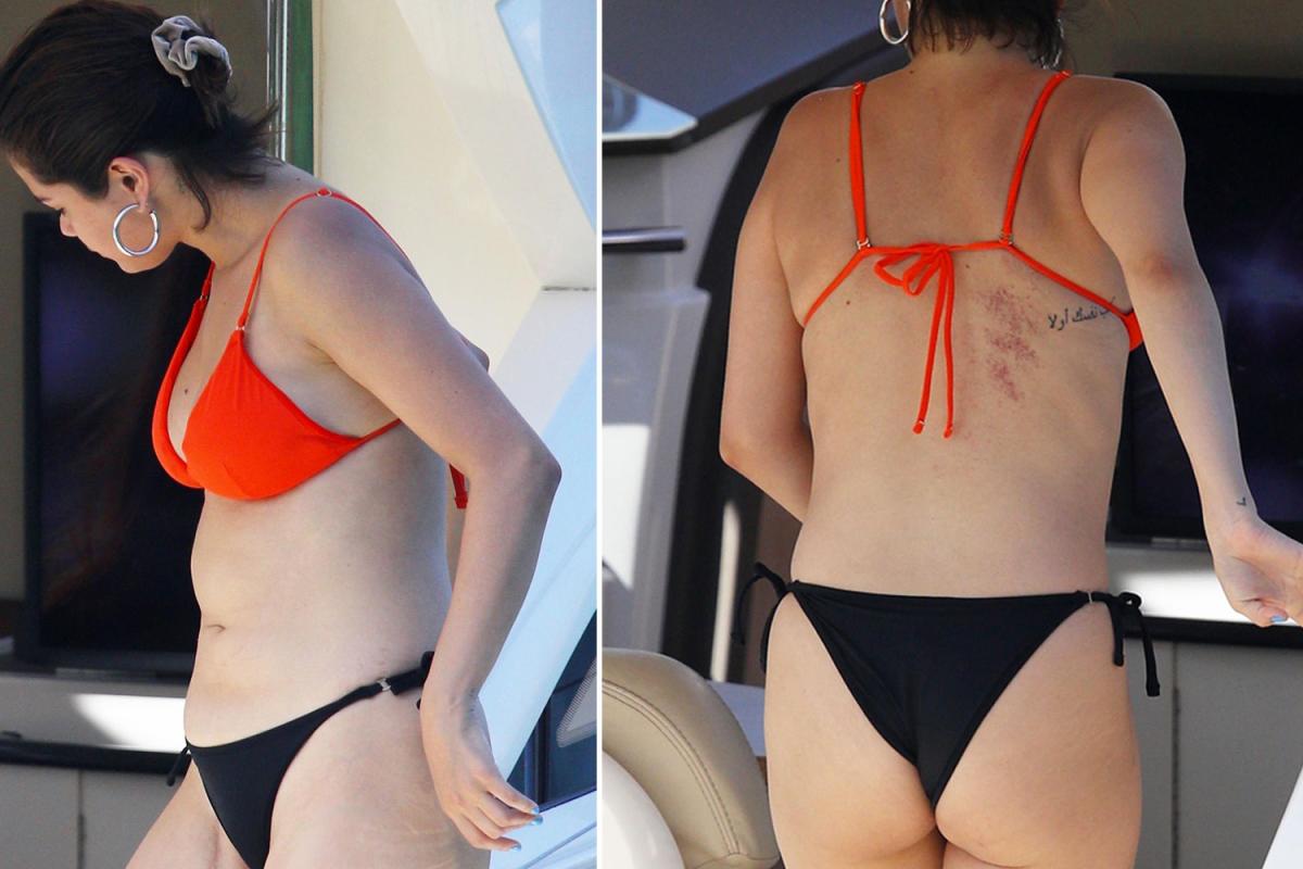 Mujer joven télex centavo Se burlan de Selena Gomez por estas fotos en bikini, sin saber lo que hay  detrás - La Opinión
