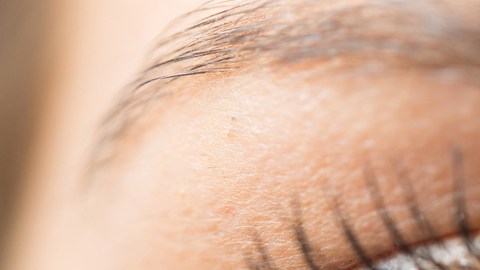 Alergias en los ojos