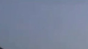 El conductor sufrió varias quemaduras.