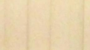 Un aumento de peso continuo dio paso a un diagnóstico de un tumor canceroso.