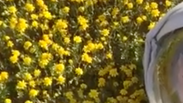 Oliver es un pequeño que tiene una rara condición en la piel, una alergia severa al sol.