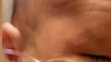 Este bebé nació sin ojos, pero lucha por tener la mejor vida posible.