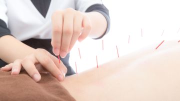 Estudio revela que la acupuntura realmente funciona para el dolor de ciática