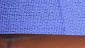 La primera cirugía de transplante con proceso de regeneración interna realizada por el cuerpo médico militar.