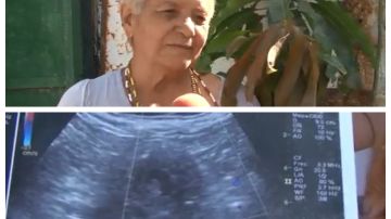 Mujer de 70 años embarazada