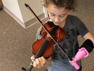 Esta niña por fin puede tocar el violín gracias al invento de un prótesis que se lo permite.