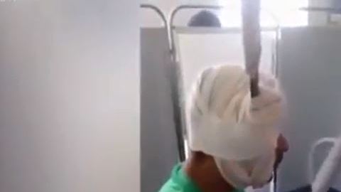 Hombre llega al hospital con machete en la cabeza