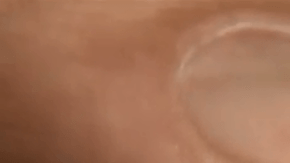 El medicamento Liraglutida es más conocido por el nombre de su marca: Saxenda.