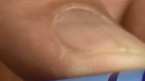 El medicamento Liraglutida es más conocido por el nombre de su marca: Saxenda.